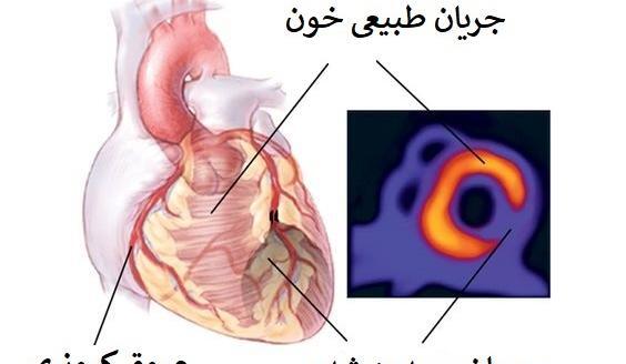عکس رنگی از قلب انسان