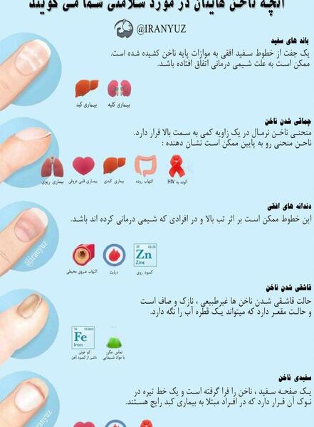 عکس ناخن قاشقی