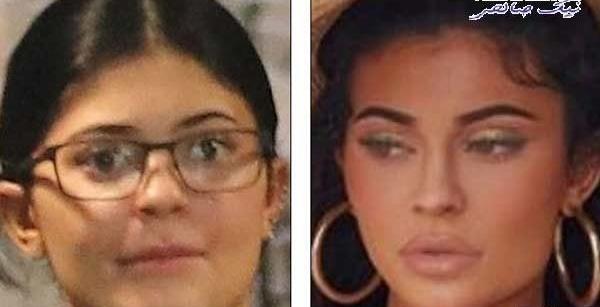 عکس قبل عمل kylie jenner