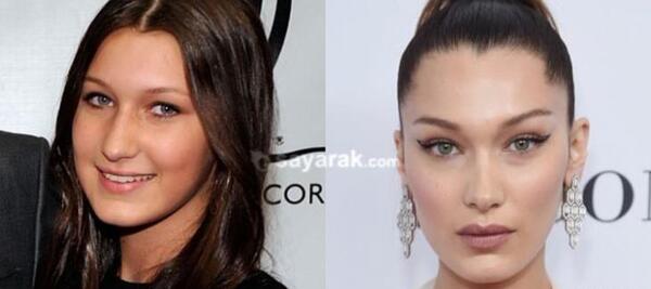 عکس قبل عمل kylie jenner