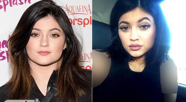 عکس قبل عمل kylie jenner