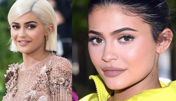 عکس قبل عمل kylie jenner