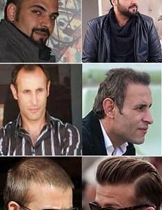 عکس کاشت مو شهاب حسینی