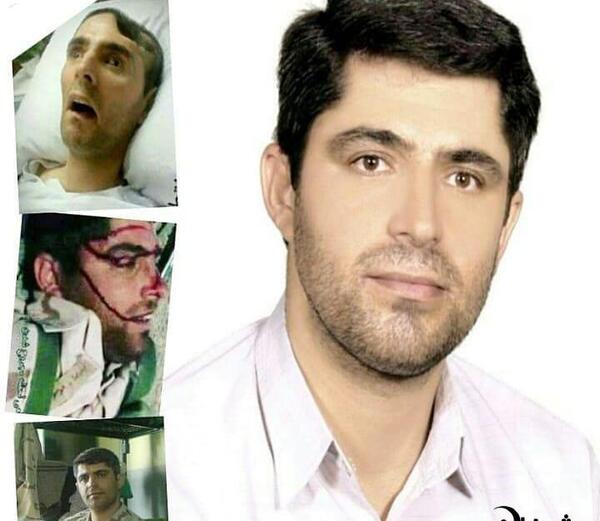 عکس شهید زنده