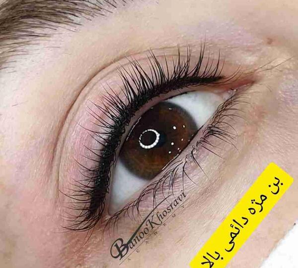 عکس کاشت بن مژه