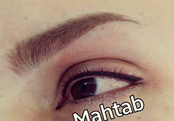 عکس کاشت بن مژه
