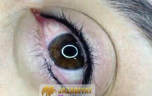 عکس کاشت بن مژه