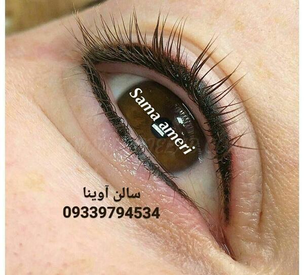 عکس کاشت بن مژه