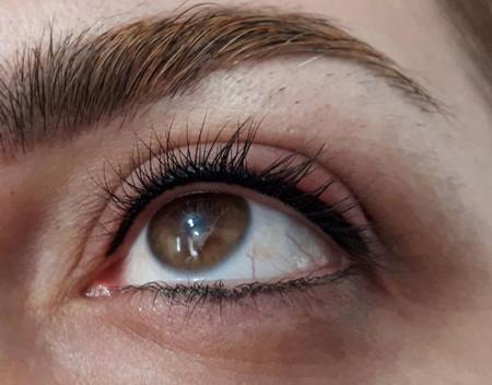 عکس کاشت بن مژه
