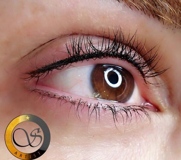 عکس کاشت بن مژه