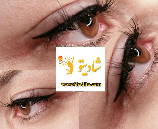 عکس کاشت بن مژه
