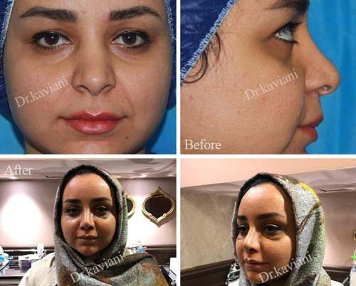 عدم تقارن صورت در عکس نی نی سایت