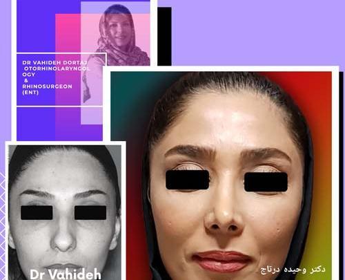عدم تقارن صورت در عکس نی نی سایت