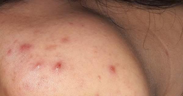 عدم تقارن صورت در عکس نی نی سایت