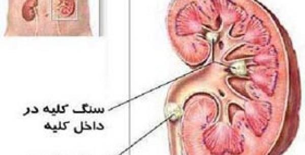عکس واقعی کلیه انسان
