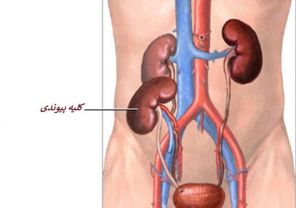 عکس واقعی کلیه انسان
