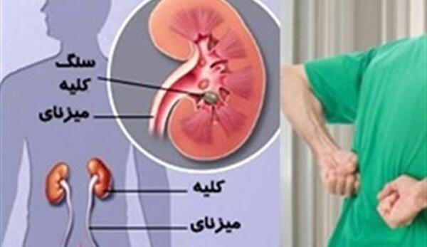 عکس واقعی کلیه انسان