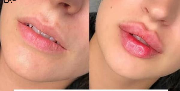 عکس لب مدل روسی