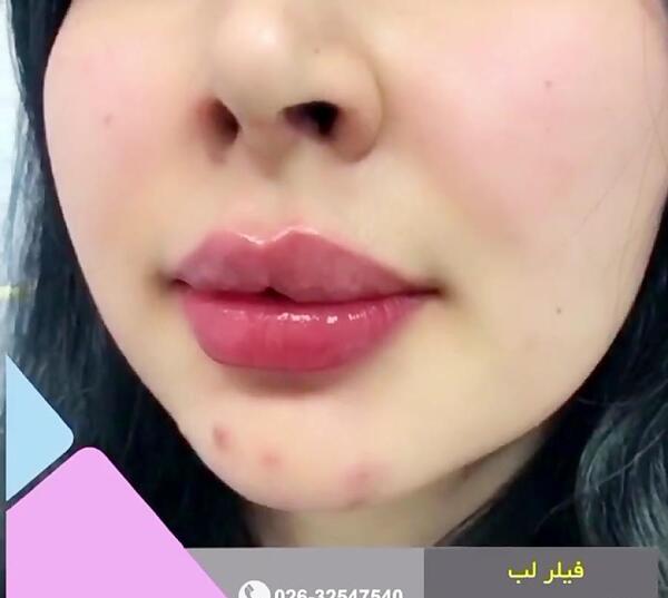 عکس لب مدل روسی