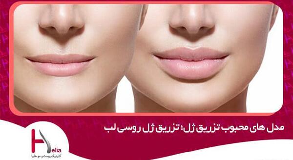 عکس لب مدل روسی