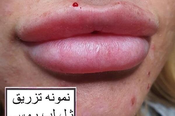 عکس لب مدل روسی