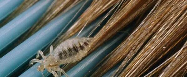 عکس شپش سر چه رنگی است