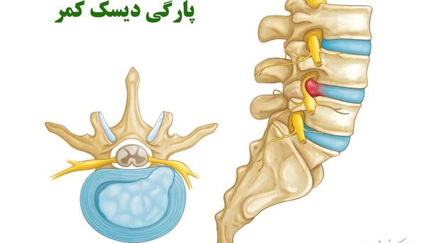 عکس ساده کمر