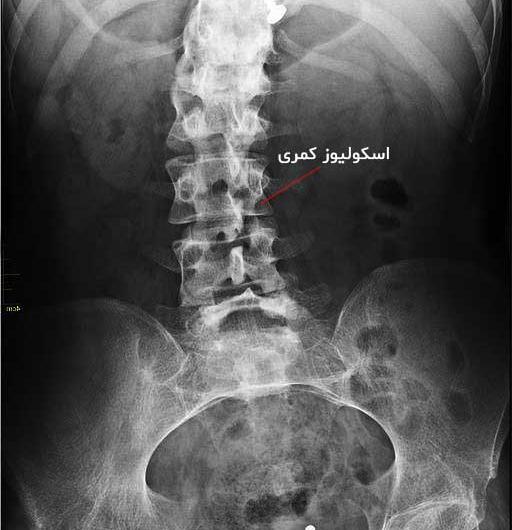 عکس ساده کمر