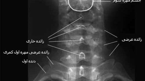 عکس ساده کمر