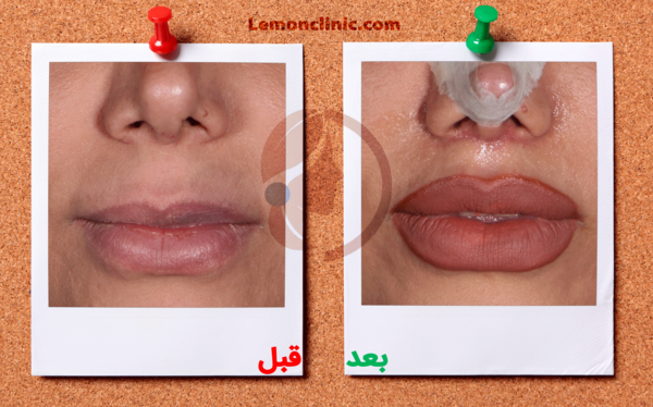 عکس لب عملی
