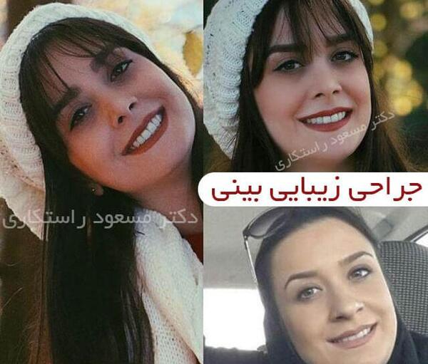 عکس محسن یگانه قبل از عمل بینی