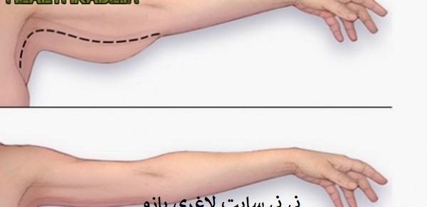 عکس بازو نی نی سایت