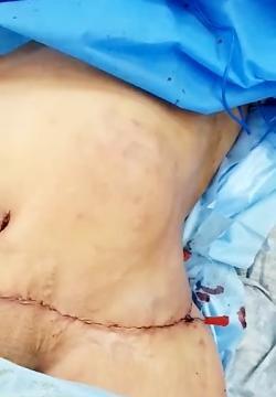 عکس بازو نی نی سایت