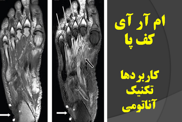 عکس ام ار ای پا