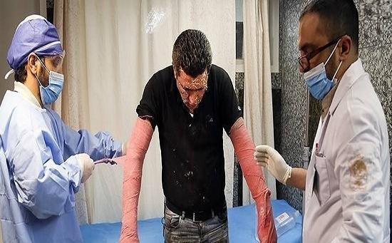 عکسهای وحشتناک چهارشنبه سوری