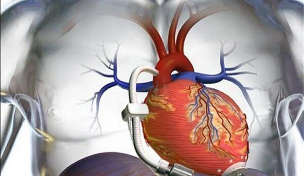 عکس قلب ریه
