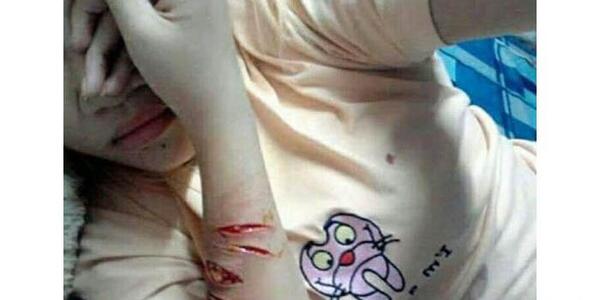 عکس خودزنی وحشتناک