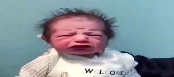 عکس نوزاد زشت