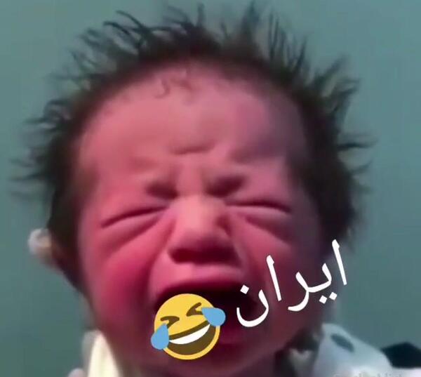 عکس نوزاد زشت