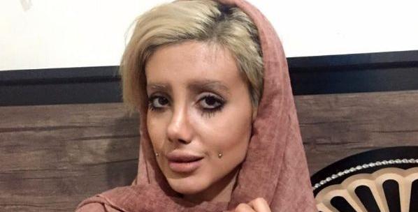 عکس قبل از عمل آنجلینا جولی