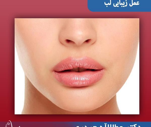 عکس لب قیطونی