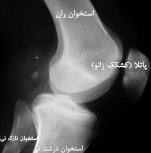 عکس ام آر آی زانوی سالم