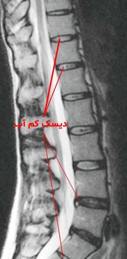 خواندن عکس ام ار ای گردن