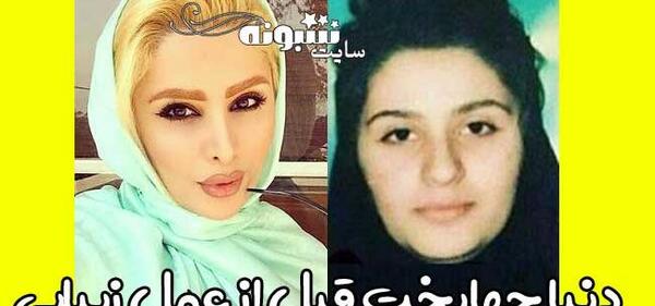 عکس قبل عمل دنیاجهانبخت