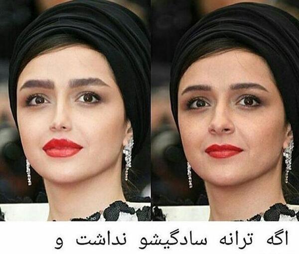 عکس قبل عمل دنیاجهانبخت