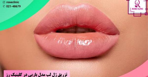 عکس لب ژل تزریق شده
