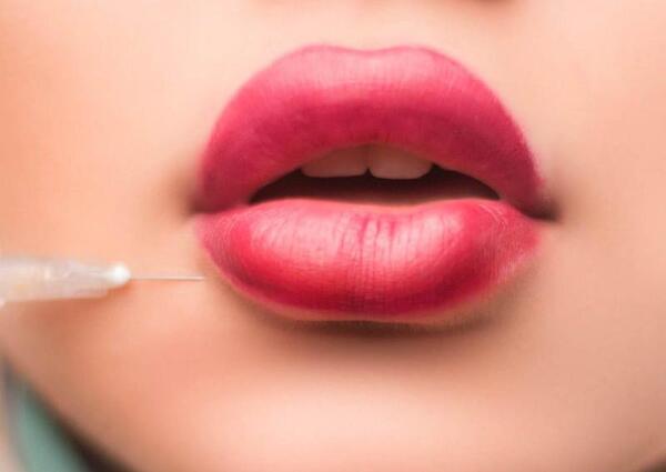 عکس لب ژل تزریق شده