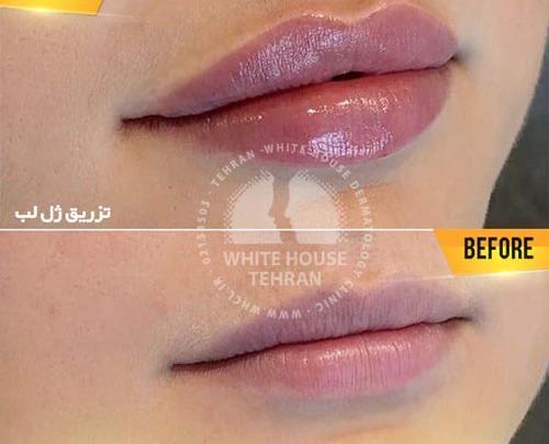 عکس لب عروسکی