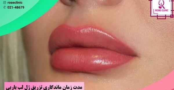 عکس لب عروسکی