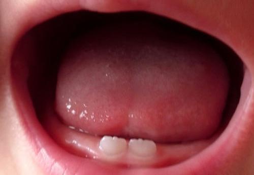 عکس لب و دندان